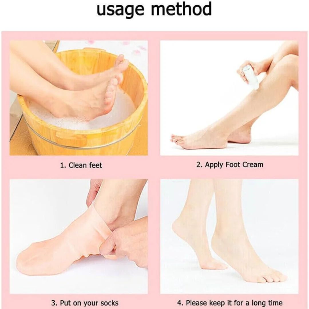 Silicon Socks: Say goodbye to cracked heels!